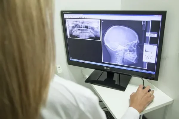Doctor reviews X-Rays